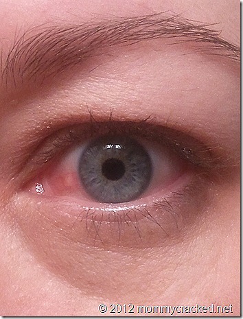 bump on my eyeball